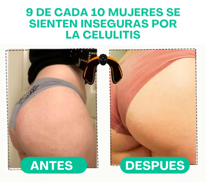 Tonificador de Glúteo Premium | Recargable